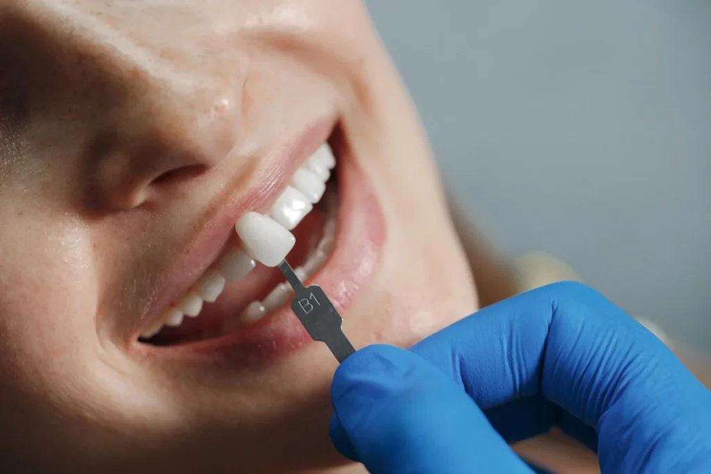 Implant dentistry