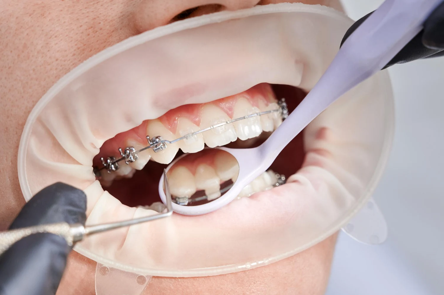 Advanced Orthodontics
